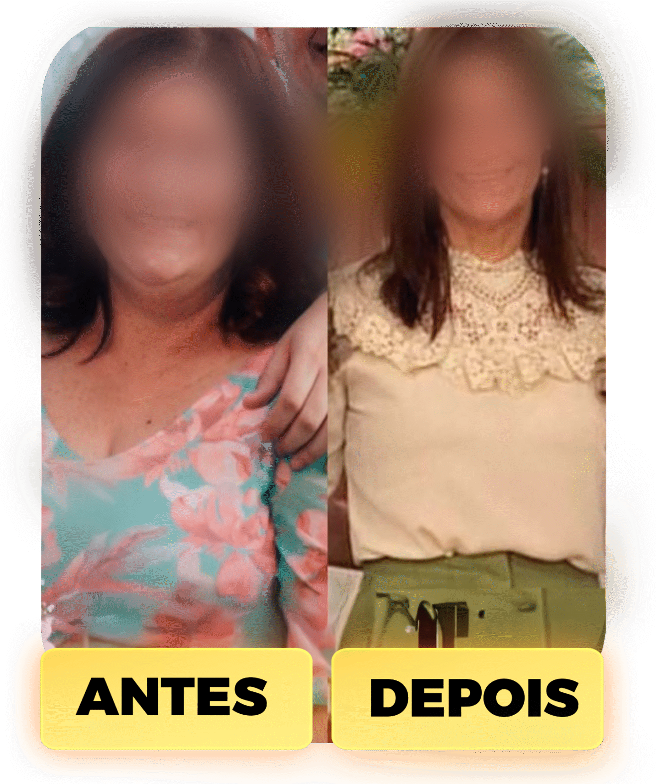 ZIZINHO ANTES E DEPOIS